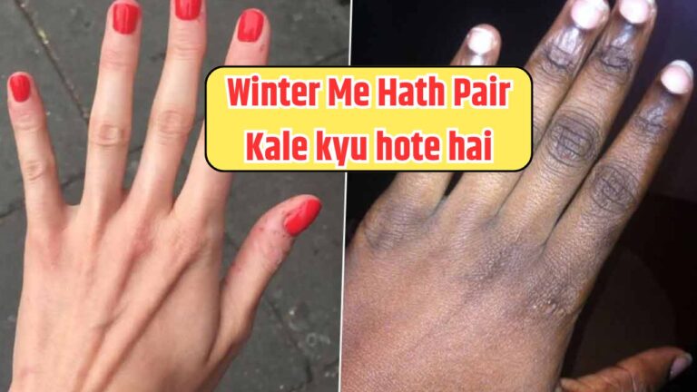 Winter me hath pair kale kyu hote hai